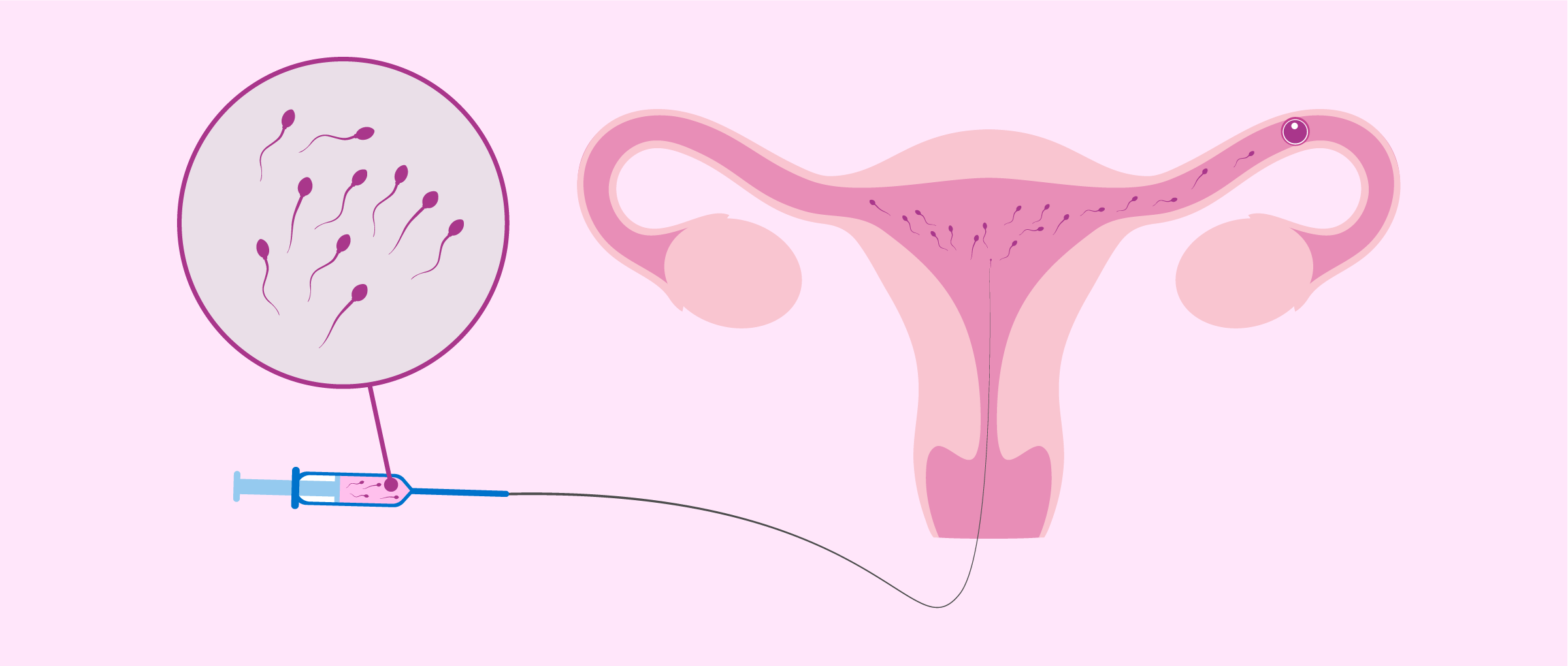 fertility & infertility treatment